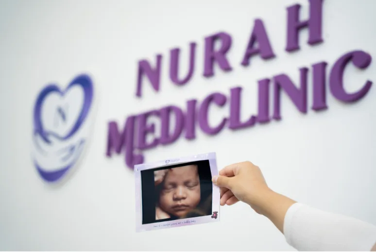 Imbasan bayi di Nurah Mediclinic Puncak Alam